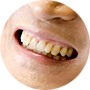 저작기능향상