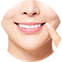 고른 치아